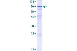AVL9 Homolog (AVL9) (AA 1-463) protein (GST tag)