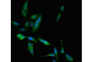 Immunofluorescent analysis of Hela cells using ABIN7171654 at dilution of 1:100 and Alexa Fluor 488-congugated AffiniPure Goat Anti-Rabbit IgG(H+L) (TBC1D4 抗体  (AA 1-94))
