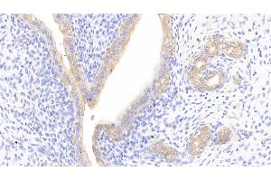 Detection of CTTN in Rat Uterus Tissue using Polyclonal Antibody to Cortactin (CTTN) (Cortactin 抗体  (AA 1-509))