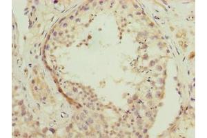 Immunohistochemistry of paraffin-embedded human testis tissue using ABIN7166731 at dilution of 1:100 (NSUN7 抗体  (AA 1-300))