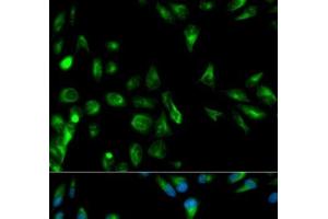 Immunofluorescence analysis of HeLa cells using RASSF1 Polyclonal Antibody (RASSF1 抗体)