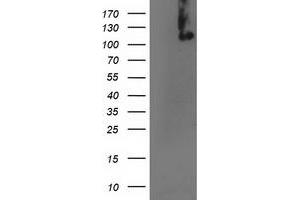 Western Blotting (WB) image for anti-Excision Repair Cross-Complementing Rodent Repair Deficiency, Complementation Group 4 (ERCC4) antibody (ABIN1498073) (ERCC4 抗体)
