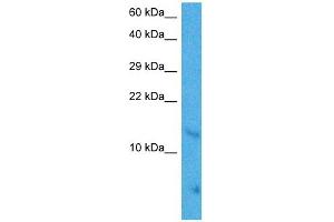 Host:  Mouse  Target Name:  MAX  Sample Tissue:  Mouse Brain  Antibody Dilution:  1ug/ml (MAX 抗体  (Middle Region))