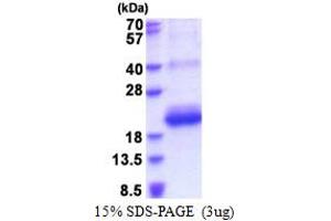 CD164 Sialomucin-Like 2 (CD164L2) (AA 30-141) protein (His tag)