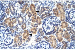 Rabbit Anti-MYCBP Antibody Catalog Number: ARP31860 Paraffin Embedded Tissue: Human Kidney Cellular Data: Epithelial cells of renal tubule Antibody Concentration: 4. (MYCBP 抗体  (Middle Region))