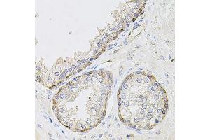 Immunohistochemistry of paraffin-embedded human prostate using CIB1 antibody (ABIN1871861) at dilution of 1:100 (40x lens). (CIB1 抗体)