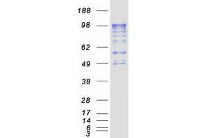 Validation with Western Blot (PDE4A Protein (Transcript Variant 4) (Myc-DYKDDDDK Tag))
