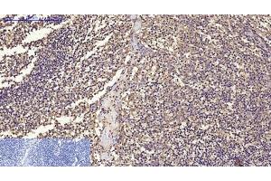 Immunohistochemistry of paraffin-embedded Human tonsil tissue using CD68 Monoclonal Antibody at dilution of 1:200. (CD68 抗体)