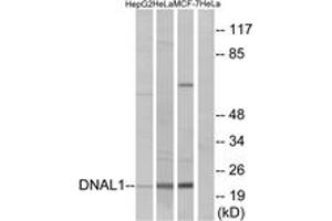 Western blot analysis of extracts from HeLa/HepG2/MCF-7 cells, using DNAL1 Antibody. (DNAL1 抗体  (AA 121-170))
