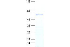 Western Blotting (WB) image for Sex Comb On Midleg-Like 4 (SCML4) protein (His tag) (ABIN5505770)