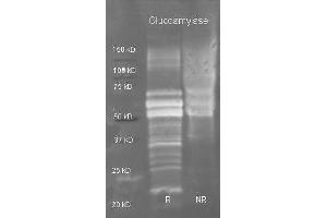 Goat anti Glucoamylase antibody ( was used to detect purified glucoamylase under reducing (R) and non-reducing (NR) conditions. (Glucoamylase 抗体  (HRP))