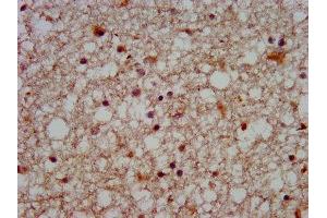 IHC image of ABIN7170083 diluted at 1:500 and staining in paraffin-embedded human brain tissue performed on a Leica BondTM system. (KCC2 抗体  (AA 944-1071))