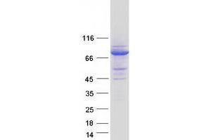 Western Blotting (WB) image for Sorting Nexin 18 (SNX18) (Transcript Variant 1) protein (Myc-DYKDDDDK Tag) (ABIN2732398)