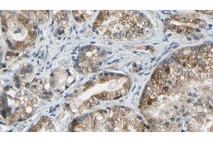 ABIN6277530 at 1/100 staining Human prostate tissue by IHC-P. (Golgin A2 (GOLGA2) (N-Term) 抗体)