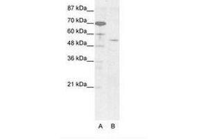 Image no. 1 for anti-Homeobox even-skipped homolog protein 2 (EVX2) (AA 63-112) antibody (ABIN203247) (EVX2 抗体  (AA 63-112))