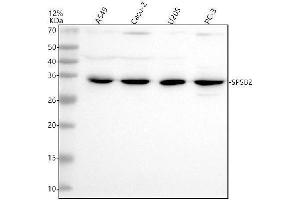 Western blot analysis of SPSB2 using anti-SPSB2 antibody (ABIN7825859).