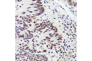 Immunohistochemistry of paraffin-embedded human colon carcinoma using RNF40 Rabbit mAb (ABIN7270074) at dilution of 1:100 (40x lens). (RNF40 抗体)