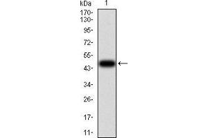 Western blot analysis using VIL1 mAb against human VIL1 (AA: 1-209) recombinant protein.