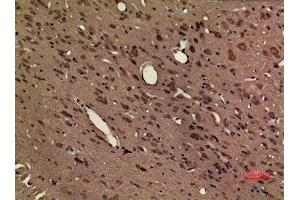 Immunohistochemistry (IHC) analysis of paraffin-embedded Rat Brain, antibody was diluted at 1:100. (CX3CR1 抗体  (Internal Region))