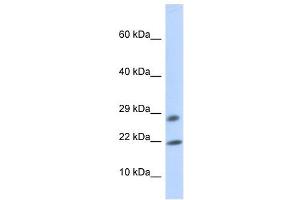 OCIAD2 antibody used at 1 ug/ml to detect target protein. (OCIAD2 抗体  (Middle Region))