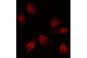 ABIN6267459 staining K562 by IF/ICC. (ENOS 抗体  (pThr495))