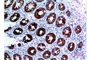 Immunohistochemistry (IHC) analysis of paraffin-embedded Human Colon, antibody was diluted at 1:100. (KRT8 抗体  (Ser726, Ser731))