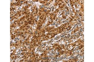 Immunohistochemistry of Human brain  using NLRP7 Polyclonal Antibody at dilution of 1:60 (NLRP7 抗体)