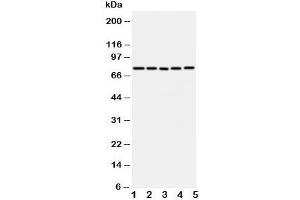 Western blot testing of ABCG1 antibody and Lane 1:  U87;  2: SMMC-7721;  3: HeLa;  4: COLO320;  5: MCF-7 cell lysate. (ABCG1 抗体  (C-Term))