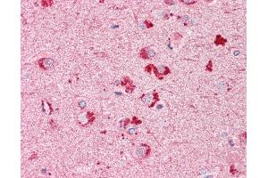 Anti-RIF1 antibody IHC of human brain, cortex. (RIF1 抗体  (AA 2076-2089))