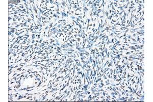 Immunohistochemical staining of paraffin-embedded colon tissue using anti-PPP5Cmouse monoclonal antibody. (PP5 抗体)