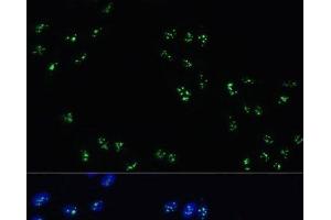 Immunofluorescence (IF) image for anti-DEAD (Asp-Glu-Ala-Asp) Box Polypeptide 21 (DDX21) antibody (ABIN7258156)
