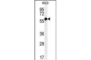 TANK Antibody (Center) (ABIN652041 and ABIN2840515) western blot analysis in WiDr cell line lysates (35 μg/lane). (TANK 抗体  (AA 88-114))