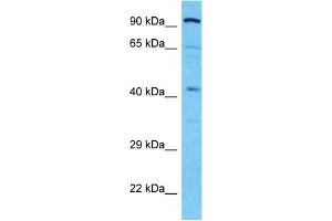Host:  Rabbit  Target Name:  ALDOB  Sample Type:  721_B Whole Cell lysates  Antibody Dilution:  1. (ALDOB 抗体  (N-Term))