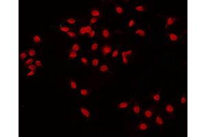 Immunofluorescence (fixed cells) (IF/ICC) image for anti-O6-Methylguanine-DNA-Methyltransferase (MGMT) (N-Term) antibody (ABIN6263244)