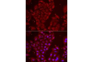 Immunofluorescence analysis of U2OS cell using TPP2 antibody. (Tpp2 抗体)