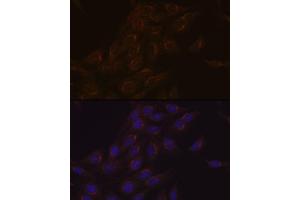 Immunofluorescence analysis of C6 cells using PIST/GOPC Rabbit mAb (ABIN1678809, ABIN1678808, ABIN7101325 and ABIN7101326) at dilution of 1:100 (40x lens). (GOPC 抗体)