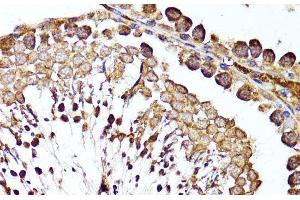 Immunohistochemistry of paraffin-embedded Rat testis using MME Polyclonal Antibody at dilution of 1:100 (40x lens). (MME 抗体)