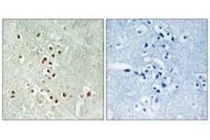 Immunohistochemistry analysis of paraffin-embedded human brain tissue using GADD45GIP1 antibody. (GADD45GIP1 抗体)