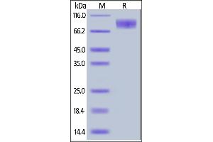 SDS-PAGE (SDS) image for Colony Stimulating Factor 1 Receptor (CSF1R) (AA 20-510) (Active) protein (His tag) (ABIN6809888)