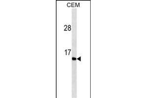 GAST Antibody ABIN1539897 western blot analysis in CEM cell line lysates (35 μg/lane). (Gastrin 抗体  (AA 49-78))