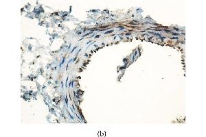 Immunohistochemical staining for MCP-1 in the graft vessels (original magnification x400).
