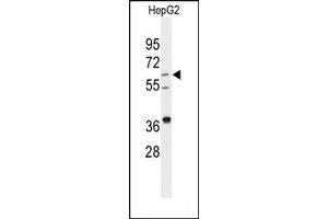 Image no. 1 for anti-24-Dehydrocholesterol Reductase (DHCR24) (Middle Region) antibody (ABIN358015) (Seladin 1 抗体  (Middle Region))
