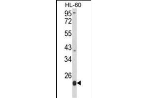 Western Blotting (WB) image for anti-Proteasome (Prosome, Macropain) Subunit, beta Type, 9 (Large Multifunctional Peptidase 2) (PSMB9) (AA 193-219), (C-Term) antibody (ABIN652496)
