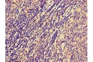 Immunohistochemistry of paraffin-embedded human lymph node tissue using ABIN7161071 at dilution of 1:100 (NCR1 抗体  (AA 121-230))
