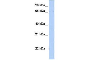 WB Suggested Anti-ZFP64 Antibody Titration:  0. (ZFP64 抗体  (N-Term))