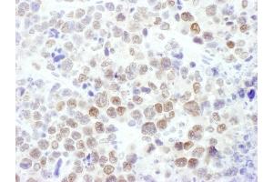 Immunohistochemistry (IHC) image for anti-Enhancer of Zeste Homolog 2 (EZH2) (AA 696-746) antibody (ABIN7450991) (EZH2 抗体  (AA 696-746))