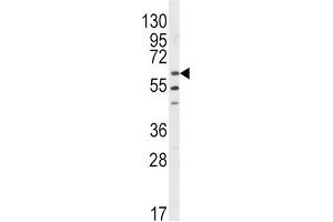 Western Blotting (WB) image for anti-V-Yes-1 Yamaguchi Sarcoma Viral Related Oncogene Homolog (LYN) antibody (ABIN3003450) (LYN 抗体)