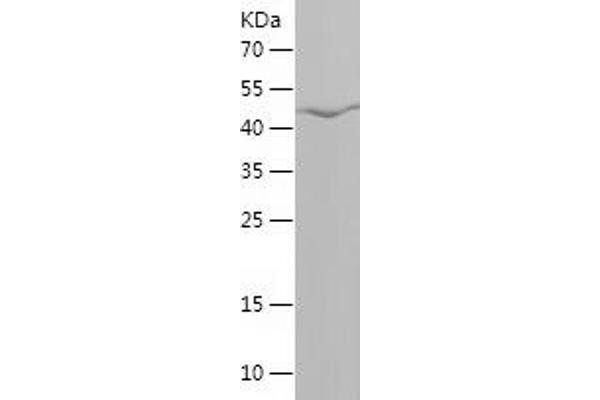 FUT9 Protein (AA 159-359) (His-IF2DI Tag)