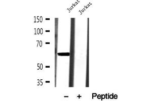 Western blot analysis of extracts of Jurkat cells, using AHCYL1 antibody. (AHCYL1 抗体  (N-Term))