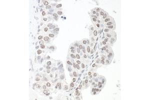 anti-SMC6 Structural Maintenance of Chromosomes 6-Like 1 (SMC6) (C-Term) antibody